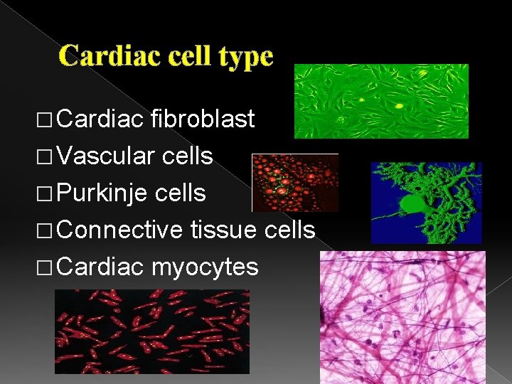 Cardiac cell type � Cardiac fibroblast � Vascular cells � Purkinje cells � Connective