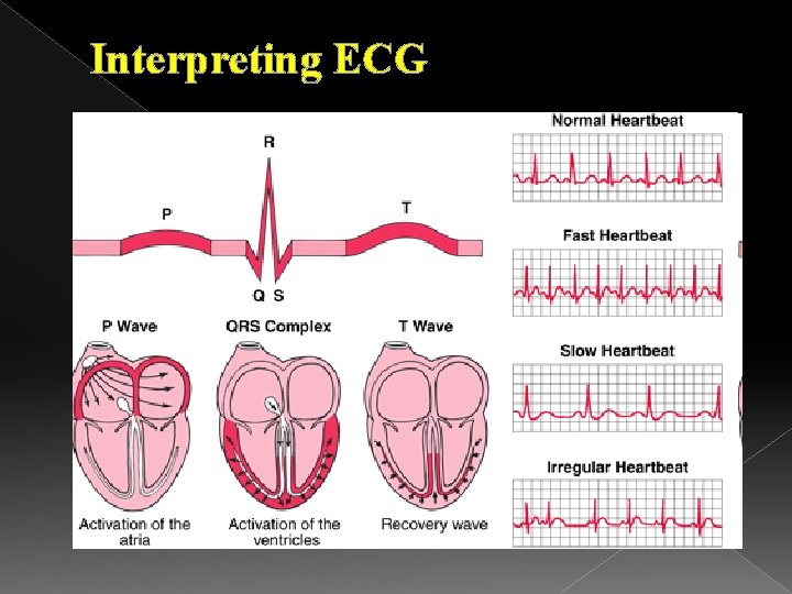 Interpreting ECG 