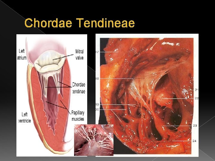 Chordae Tendineae 