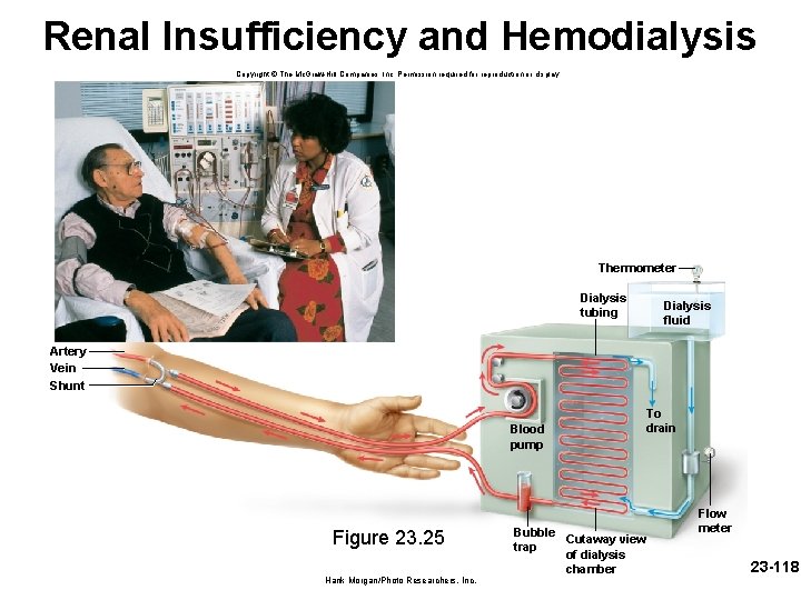 Renal Insufficiency and Hemodialysis Copyright © The Mc. Graw-Hill Companies, Inc. Permission required for Renal Insufficiency and Hemodialysis Copyright © The Mc. Graw-Hill Companies, Inc. Permission required for