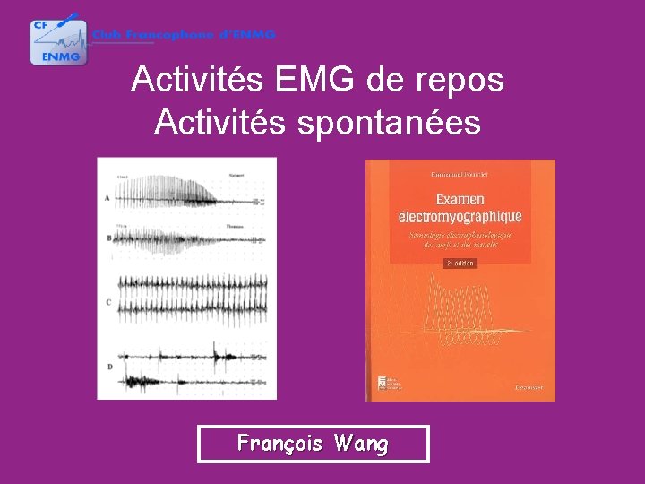 Activités EMG de repos Activités spontanées François Wang 