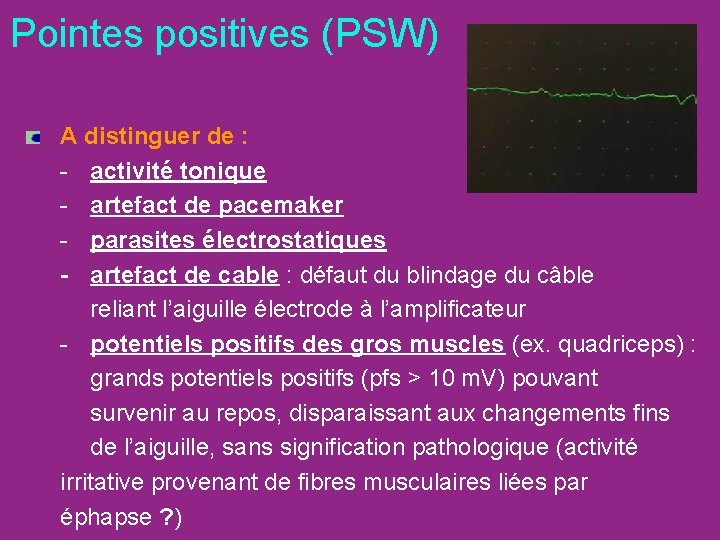 Pointes positives (PSW) A distinguer de : - activité tonique - artefact de pacemaker