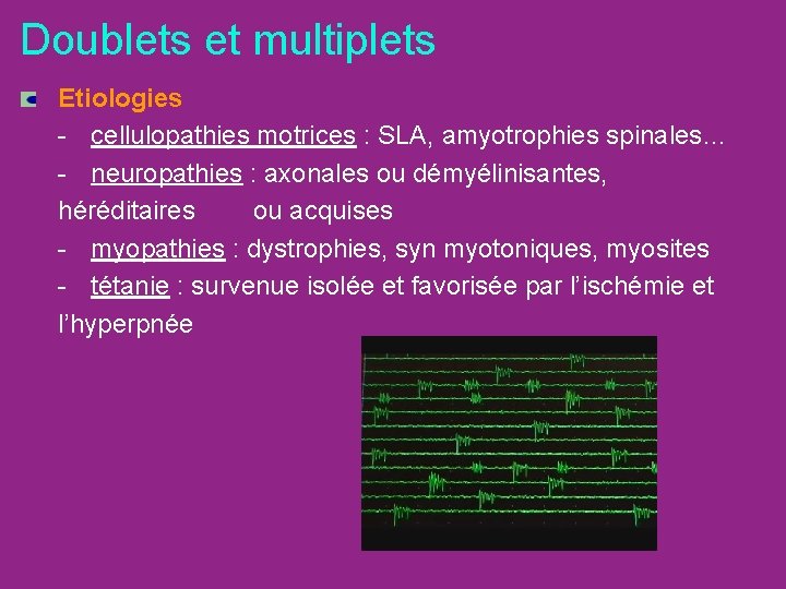 Doublets et multiplets Etiologies - cellulopathies motrices : SLA, amyotrophies spinales… - neuropathies :