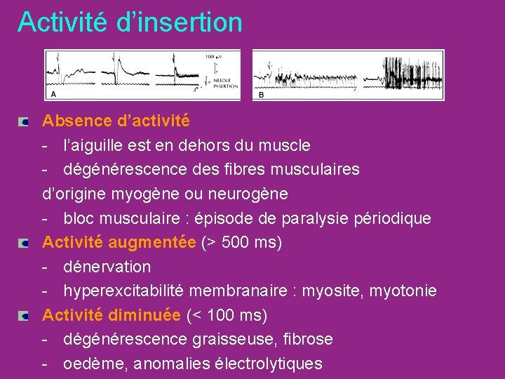 Activité d’insertion Absence d’activité - l’aiguille est en dehors du muscle - dégénérescence des