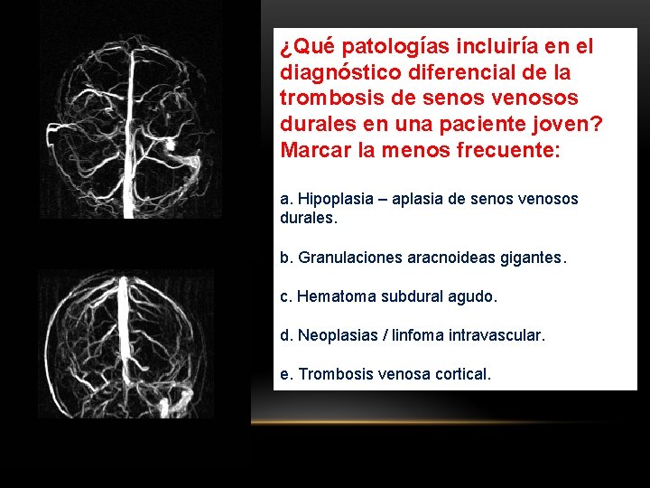 ¿Qué patologías incluiría en el diagnóstico diferencial de la trombosis de senos venosos durales