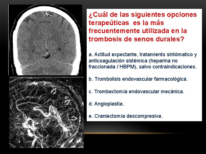 ¿Cuál de las siguientes opciones terapeúticas es la más frecuentemente utilizada en la trombosis