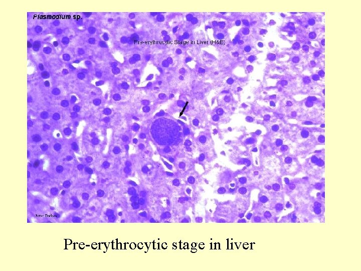 Pre-erythrocytic stage in liver 