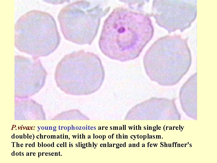 P. vivax: young trophozoites are small with single (rarely double) chromatin, with a loop