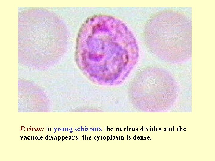 P. vivax: in young schizonts the nucleus divides and the vacuole disappears; the cytoplasm