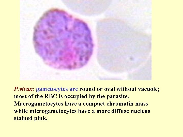 P. vivax: gametocytes are round or oval without vacuole; most of the RBC is