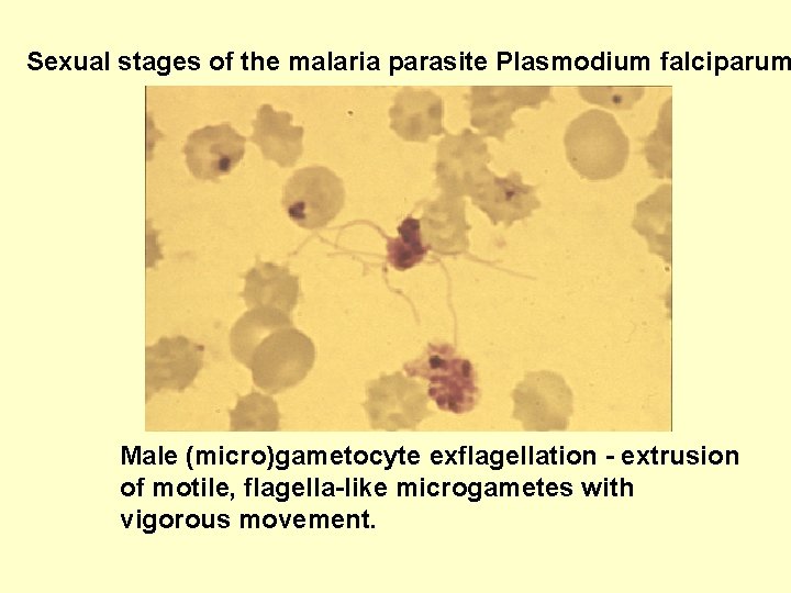 Sexual stages of the malaria parasite Plasmodium falciparum Male (micro)gametocyte exflagellation - extrusion of