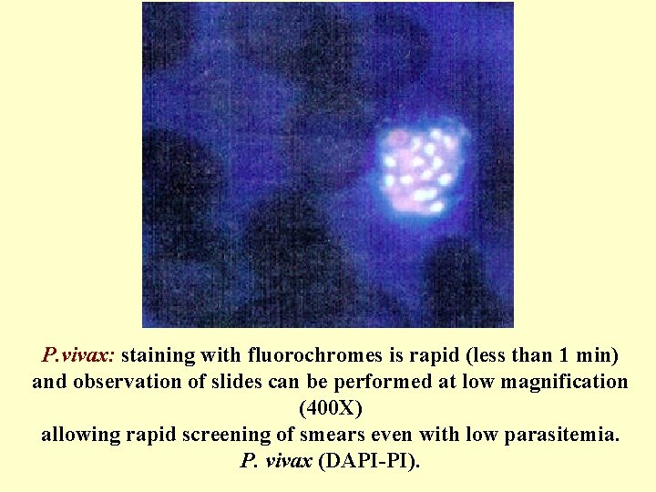 P. vivax: staining with fluorochromes is rapid (less than 1 min) and observation of