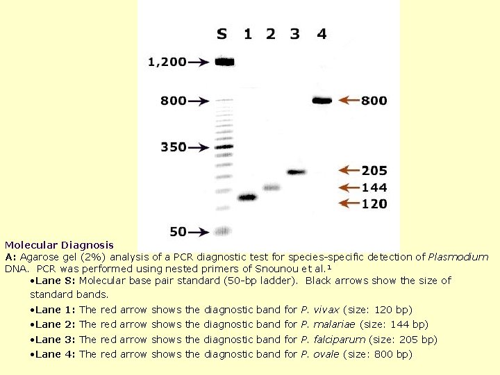 Molecular Diagnosis A: Agarose gel (2%) analysis of a PCR diagnostic test for species-specific