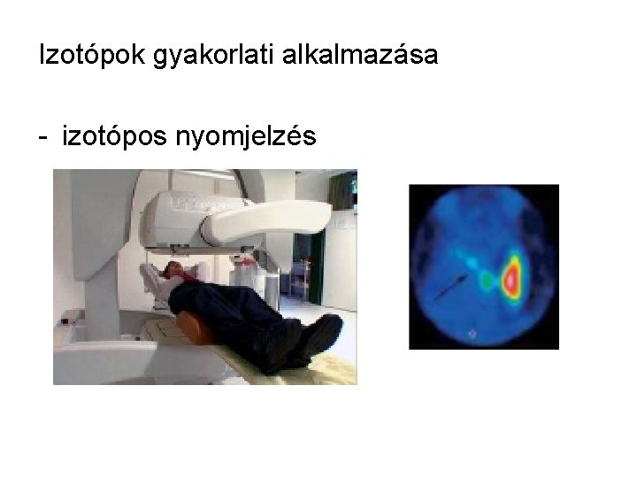 Izotópok gyakorlati alkalmazása - izotópos nyomjelzés 