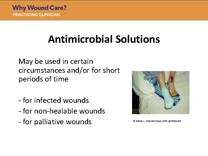 Antimicrobial Solutions May be used in certain circumstances and/or for short periods of time