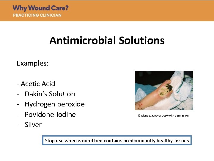 Antimicrobial Solutions Examples: - Acetic Acid - Dakin’s Solution - Hydrogen peroxide - Povidone-iodine