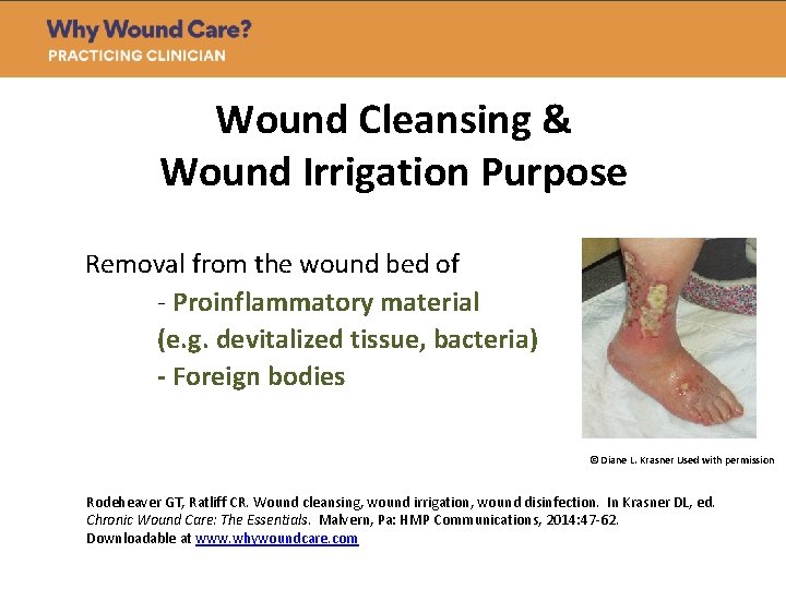 Wound Cleansing & Wound Irrigation Purpose Removal from the wound bed of - Proinflammatory