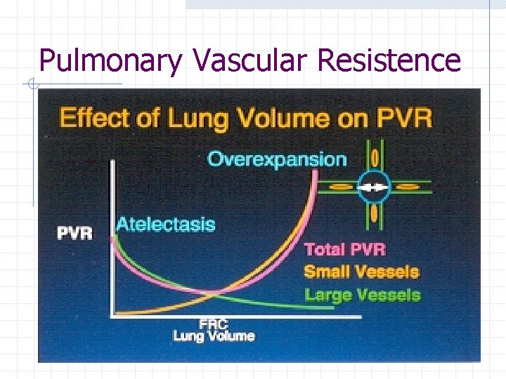 Pulmonary Vascular Resistence Pulmonary Vascular Resistence