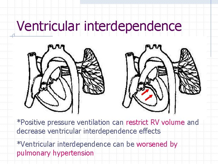 Ventricular interdependence *Positive pressure ventilation can restrict RV volume and decrease ventricular interdependence effects Ventricular interdependence *Positive pressure ventilation can restrict RV volume and decrease ventricular interdependence effects