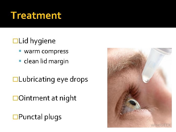 Treatment �Lid hygiene warm compress clean lid margin �Lubricating eye drops �Ointment at night