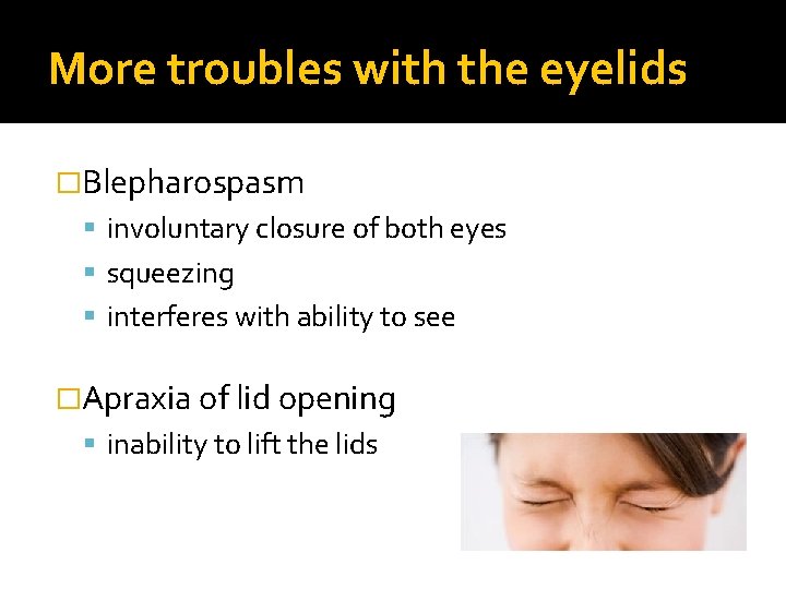 More troubles with the eyelids �Blepharospasm involuntary closure of both eyes squeezing interferes with