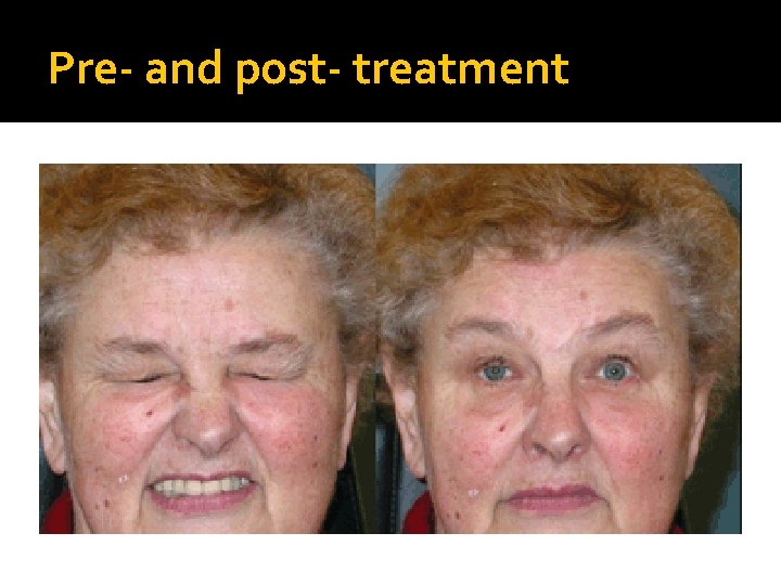 Pre- and post- treatment 