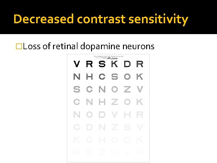Decreased contrast sensitivity �Loss of retinal dopamine neurons 