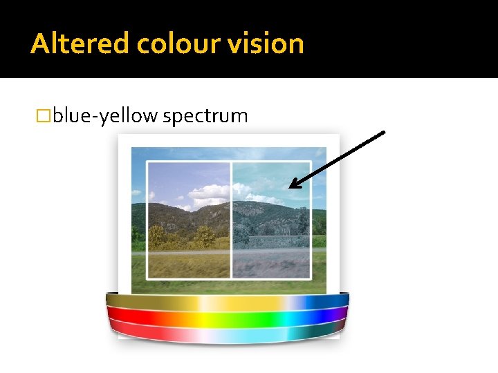 Altered colour vision �blue-yellow spectrum 