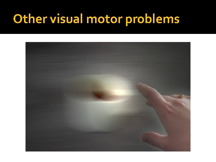 Other visual motor problems 