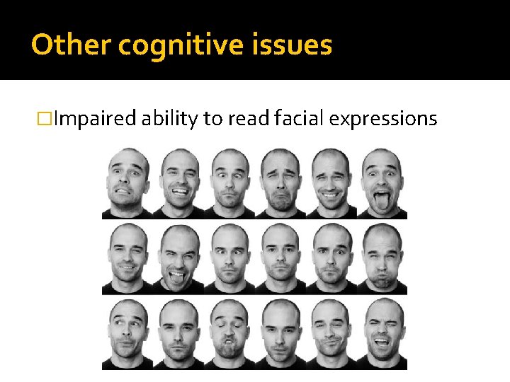 Other cognitive issues �Impaired ability to read facial expressions 