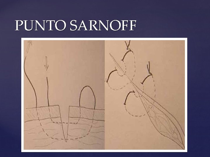 PUNTO SARNOFF 