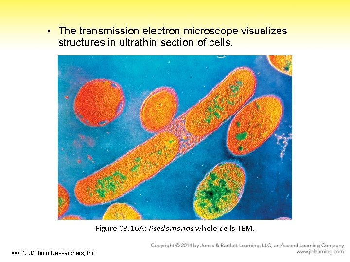  • The transmission electron microscope visualizes structures in ultrathin section of cells. Figure