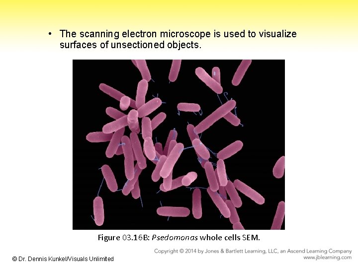  • The scanning electron microscope is used to visualize surfaces of unsectioned objects.