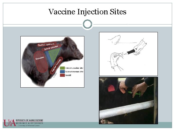 Vaccine Injection Sites 