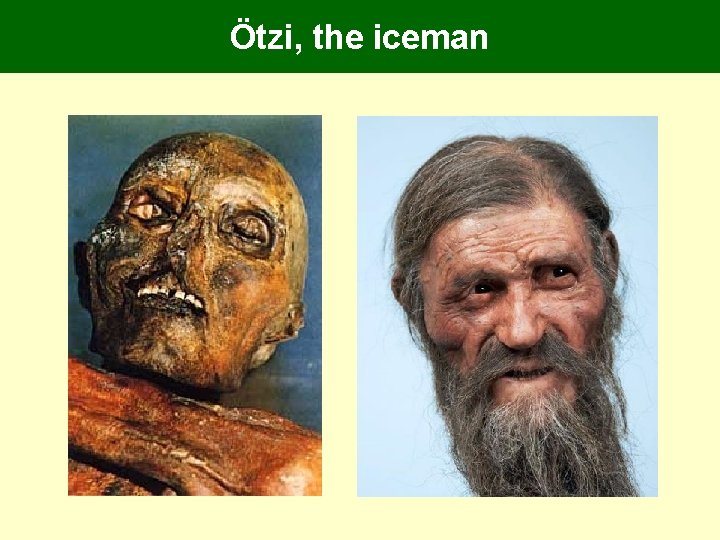 Ötzi, the iceman Ötzi, the iceman