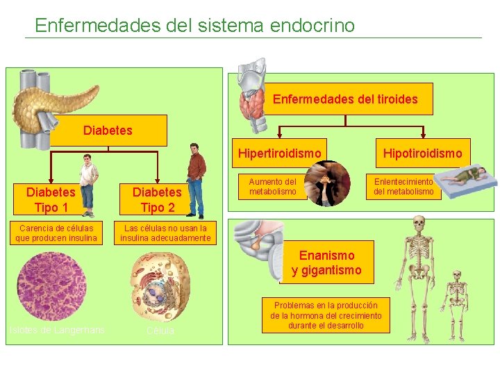 Enfermedades del sistema endocrino Enfermedades del tiroides Diabetes Hipertiroidismo Diabetes Tipo 1 Carencia de