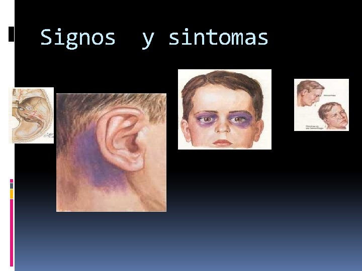 Signos y sintomas 