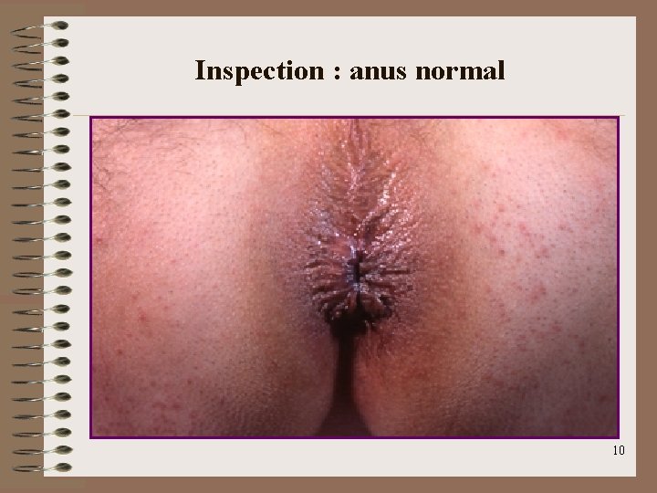 Inspection : anus normal 10 