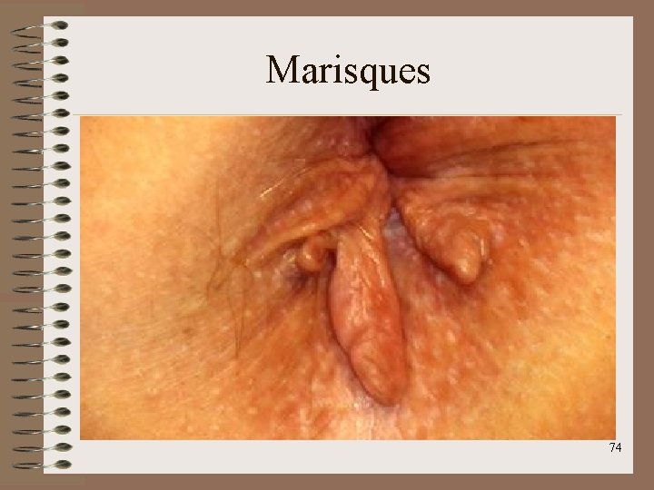 Marisques 74 