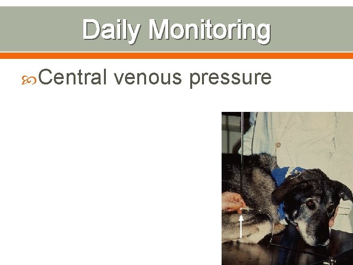 Daily Monitoring Central venous pressure 