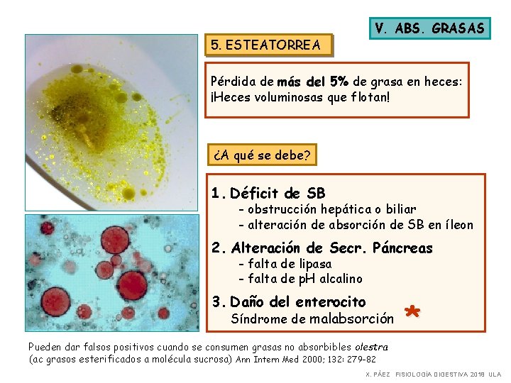 5. ESTEATORREA V. ABS. GRASAS Pérdida de más del 5% de grasa en heces: