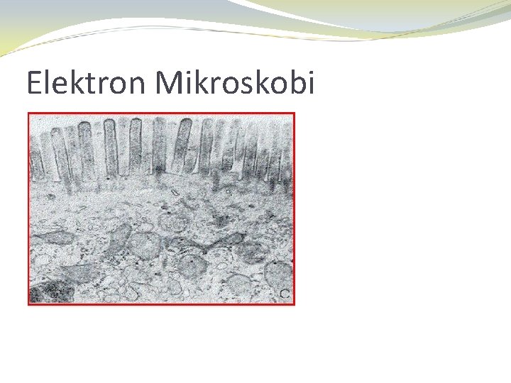 Elektron Mikroskobi 