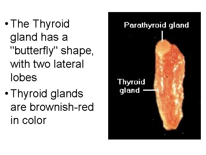  • The Thyroid gland has a "butterfly" shape, with two lateral lobes •