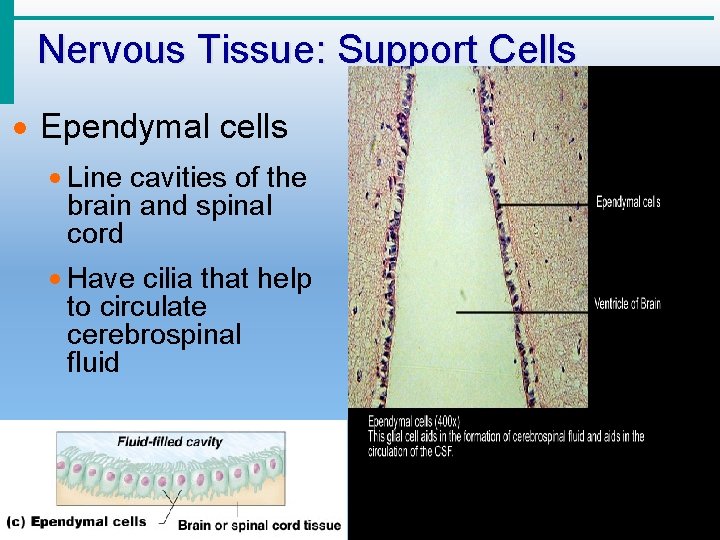 Nervous Tissue: Support Cells · Ependymal cells · Line cavities of the brain and