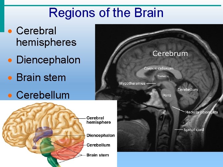 Regions of the Brain · Cerebral hemispheres · Diencephalon · Brain stem · Cerebellum