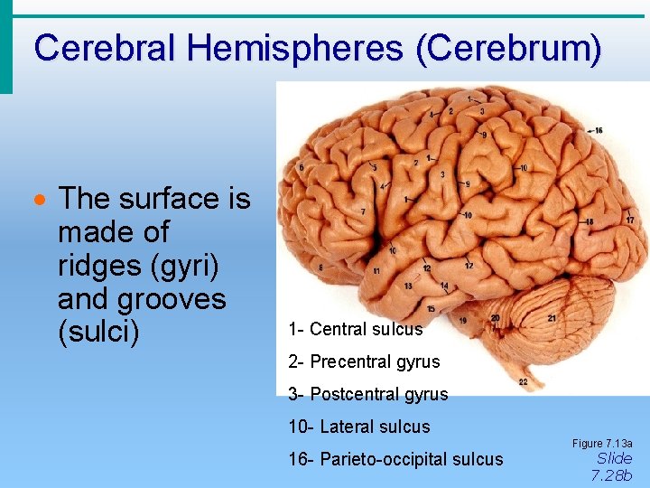 Cerebral Hemispheres (Cerebrum) · The surface is made of ridges (gyri) and grooves (sulci)