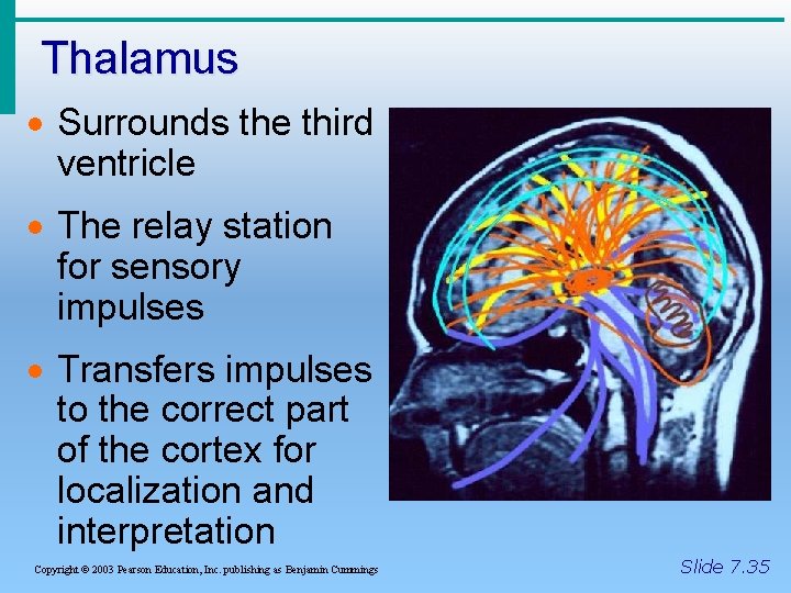 Thalamus · Surrounds the third ventricle · The relay station for sensory impulses ·