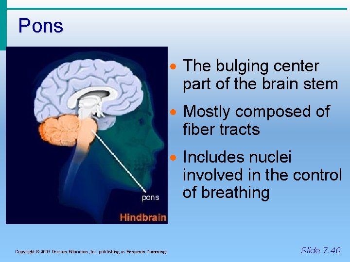 Pons · The bulging center part of the brain stem · Mostly composed of