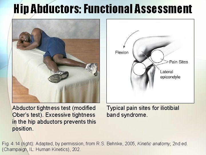 Hip Abductors: Functional Assessment Abductor tightness test (modified Ober’s test). Excessive tightness in the