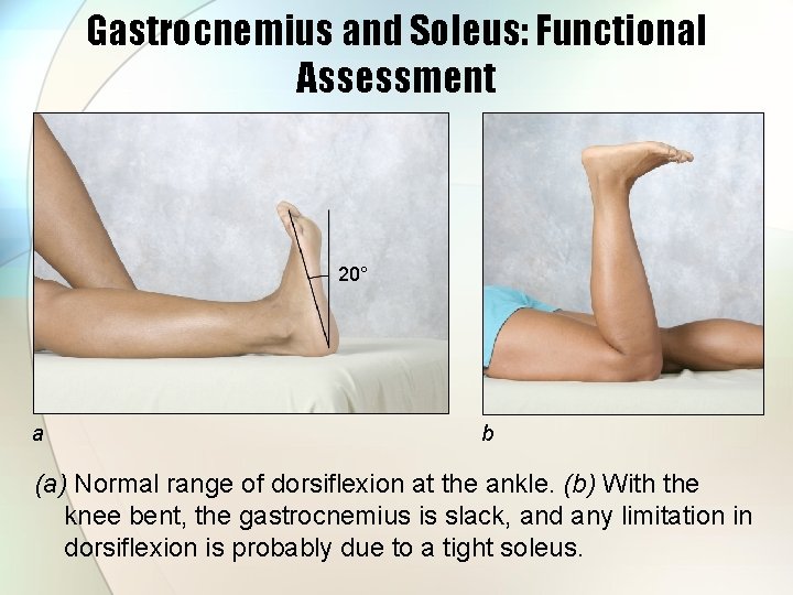 Gastrocnemius and Soleus: Functional Assessment 20° a b (a) Normal range of dorsiflexion at